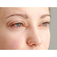 「目のかゆみ」がつらすぎる…その花粉症、実は“肝の疲れ”かも？漢方の専門家がおすすめする「酸味」と「苦味」の食べ物