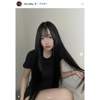 「月曜から夜ふかし」多田さん、両顎＆輪郭手術の術後2ヶ月ビフォーアフター公開「小顔になってる」「リアルで参考になる」と反響