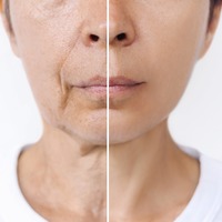 「電車の窓に映った自分にゾッ！」実は「たるみ」を加速させるNG行動とは【50代美白のカリスマ・さきめぐ先生に聞いた】