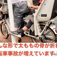 こんな形で太ももの骨が折れる事故が増えています