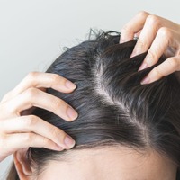 40代が猛暑でベタついた頭皮を放置すると「オバ見え」一直線！？「もしかして加齢臭？」ニオイやかゆみ、抜け毛など更年期世代の頭皮トラブルが招く「避けたい事態」と原因、対処法とは？