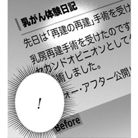 「再建の再建？」その手があったのか！自分の胸に希望が湧いてきた！【Dressing　美容外科医　森野まりあ #８】