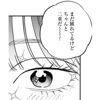 「本物だ！」ついにやった二重整形。アイテープとは違った感動を覚えて…【Dressing　美容外科医　森野まりあ #18】