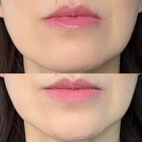 40・50代が老けて見えるのはリップの色のせい？オバ見えリップの特徴【2025年度ベスト記事セレクション】