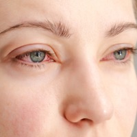 「目のかゆみ」がつらすぎる…その花粉症、実は“肝の疲れ”かも？漢方の専門家がおすすめする「酸味」と「苦味」の食べ物