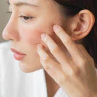 花粉の肌荒れを加速する、NGお手入れとは。40代50代は侮っていると長期化する恐れも……！