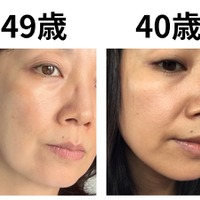 40代で肌年齢−14歳! 美容医療なしで「40歳より透明感が出た」49歳美容ライターがリピ買いする美容成分TOP2