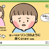厚生労働省、伝染性紅斑（リンゴ病）に注意喚起