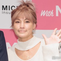 梅宮アンナ、全治5週間の怪我を報告「痛い」レントゲン写真も公開