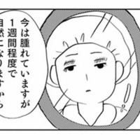 「整形しないと幸せになれない」中学卒業後、母の勧めで二重整形をすることに【親に整形させられた私が母になる #１】