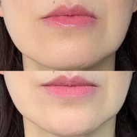 40・50代が老けて見えるのはリップの色のせい？オバ見えリップの特徴【2025年度ベスト記事セレクション】