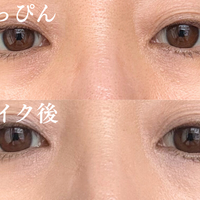 どんなに塗っても消えない。40代の黒クマがメイクでカバーできない理由