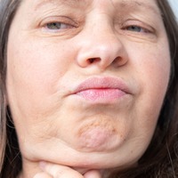 顔がたるむ人、たるまない人の違いって？ 医師が明かす「年齢だけじゃない」原因とは