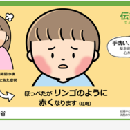 厚生労働省、伝染性紅斑（リンゴ病）に注意喚起