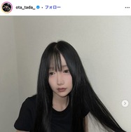 「月曜から夜ふかし」多田さん、両顎＆輪郭手術の術後2ヶ月ビフォーアフター公開「小顔になってる」「リアルで参考になる」と反響