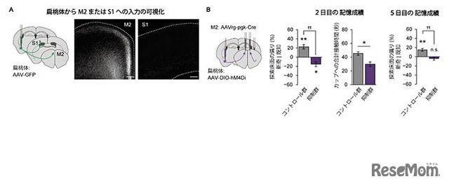 M2に入力する扁桃体神経細胞の抑制によるメス記憶と床面記憶の強化の阻害