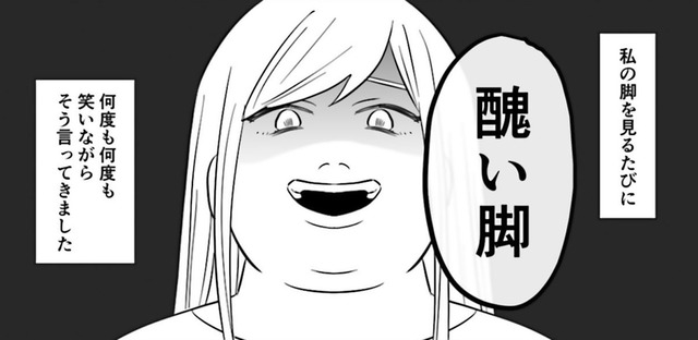 「醜い脚」母は私の脚を見る度、笑いながら嫌味を繰り返【毒親に育てられました２ #18】