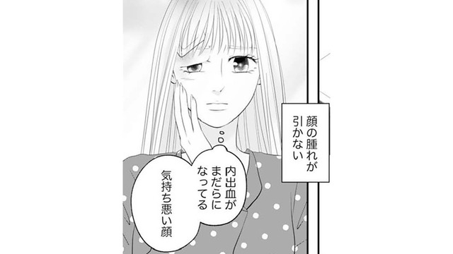 顔だけが取り柄の私なのに腫れが引かない。これからどうすればいいの？【かつて女の子だった人たちへ #32】