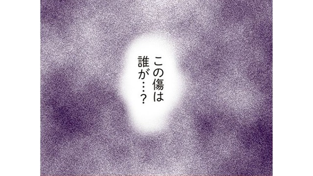 車についてしまったキズ。いったい誰がつけたんだろう。あれ？子どもたちが手に持っているものって……【犯人は私だけが知っている～母たちは静観する～ #５】