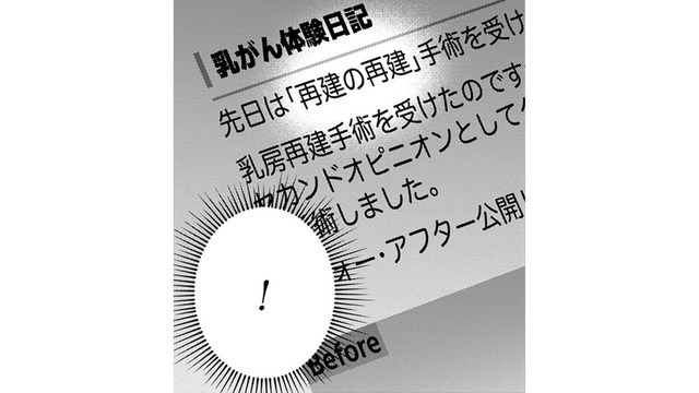「再建の再建？」その手があったのか！自分の胸に希望が湧いてきた！【Dressing　美容外科医　森野まりあ #８】