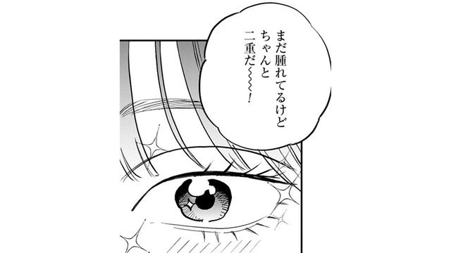 「本物だ！」ついにやった二重整形。アイテープとは違った感動を覚えて…【Dressing　美容外科医　森野まりあ #18】