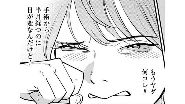 ダウンタイム 終わったはずなのに目が変。どうしたらいいの?【Dressing 美容外科医 森野まりあ #21】