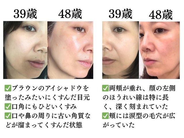 肌年齢マイナス14歳美容のプロが本当に続けて良かった美容法とは？