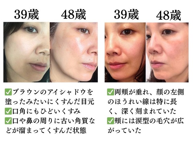 心から老けていた美容のプロが肌年齢マイナス14歳になるまでやめた美容。やめてよかった第一位は？