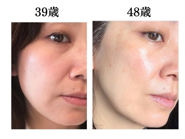 頭や首、肩のコリも老け肌につながっていた。肌年齢マイナス14歳美容のプロがやめたこととは？