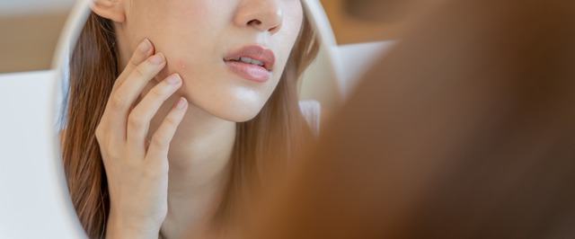 しっとりすっぴん肌が花粉肌荒れのトリガーかも！ゆらぐ肌を守るベースメイクの極意