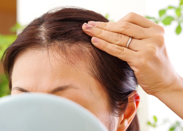 「抜け毛」が増えるのは、季節の変わり目のせい？ストレスのせい？「育毛鍼灸師が教える「異常信号」と、髪を生やすためにできること