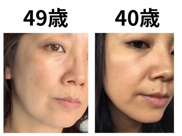 40代で肌年齢−14歳！ 美容医療なしで「40歳より透明感が出た」49歳美容ライターがリピ買いする美容成分TOP2
