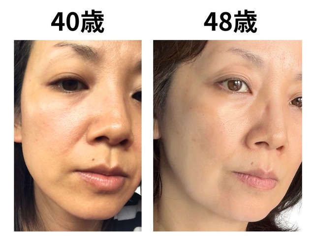49歳で肌年齢−14歳。美容のプロが「5年愛用する美容成分」第3位と第2位