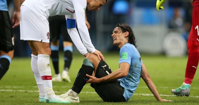 カバーニ、W杯準々決勝はどうなる…ウルグアイ代表が怪我について発表