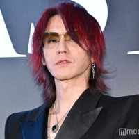 SUGIZO「FNS歌謡祭」骨折したまま生出演していた「どおりで傷みが…」 画像