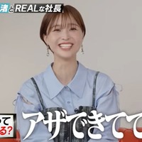 渡邊渚、ギャップ感じた人物告白 第一印象は「あざができていて本当に怖い」 画像