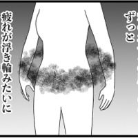 「更年期のホルモン補充治療」ってどんな感じ? 受けてみて、驚きの結果はいかに⁉【100人の更年期 #14】 画像