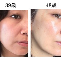 頭や首、肩のコリも老け肌につながっていた。肌年齢マイナス14歳美容のプロがやめたこととは？ 画像