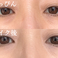 どんなに塗っても消えない。40代の黒クマがメイクでカバーできない理由 画像