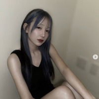 「月曜から夜ふかし」多田さん「むくみや腫れはかなり残る」両顎整形手術からDT21日目のリアルな姿公開「本当に大変そうで心配」の声 画像