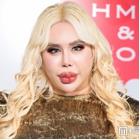 “整形総額1億円超え”アレン様、月の美容費は「140〜150万円」唇ヒアルロン酸注射事情もぶっちゃけ「針穴から漏れ出るくらい…」 画像