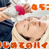 【美容】45歳、はじめてのハイフ。たるんだ顔はどれだけ変わるのか！？ 画像
