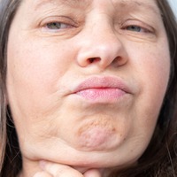 顔がたるむ人、たるまない人の違いって？ 医師が明かす「年齢だけじゃない」原因とは 画像